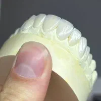 کاراموز دندانسازی