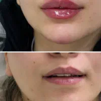 میکرو بلید ابرو|خدمات آرایشگری و زیبایی|مشهد, کوی المهدی|دیوار