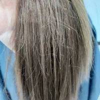 مو خوره گیری|خدمات آرایشگری و زیبایی|شوشتر, |دیوار