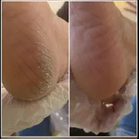پدیکور «دست پا»واکستنشن موطبیعی