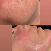 فیشال پوست تخفیف ۲۰درصد به مدت یک هفته