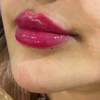 فروش و مدل ژل و بوتاکس|خدمات آرایشگری و زیبایی|اندیکا, |دیوار