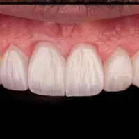 نیاز به عکاس حرفه‌ای دندانپزشکی (عکاسی+ادیت تخصصی)