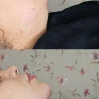 کیلینک زیبایی پاستور تخصصی ترین کیلینک زنجان|خدمات آرایشگری و زیبایی|زنجان, |دیوار