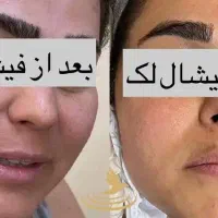 فیشیال