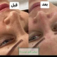 فیشیال .اسپای روسی.میکاپ حرفه ای فقط سه روز|خدمات آرایشگری و زیبایی|ایلام, |دیوار