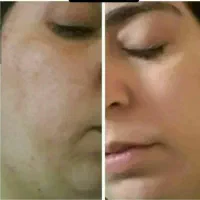 پاکسازی فوری کبد ولاغری با محصولات طبیعی|آرایشی، بهداشتی، درمانی|تربتحیدریه, رضاشهر|دیوار