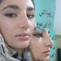 تکنسین ژل و بوتاکس و زیبایی خانم ها و آقایان|خدمات آرایشگری و زیبایی|اهواز, کوی فرهنگیان ۲|دیوار