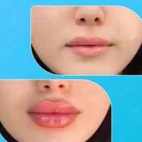فیلر لب نچرال