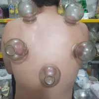 حجامت اصولی در منزل ومطب|خدمات آرایشگری و زیبایی|رشت, حومه رشت|دیوار