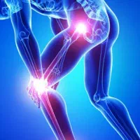درمان مشکلات مفاصل بدون بازگشت