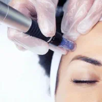 میکرو نیدلینگ/مزونیدلینگ