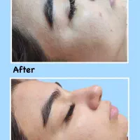 فیشیال ،آبرسانی