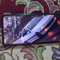 شیائومی x3pro