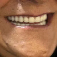 پارسیل اکریلیکی|آرایشی، بهداشتی، درمانی|تبریز, |دیوار