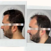 محصول معجزه اسا رویش مجددمو و ضدریزش در 83 روز|آرایشی، بهداشتی، درمانی|تهران, سعادت‌آباد|دیوار
