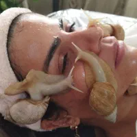 فروش فوق العاده حلزون طبی