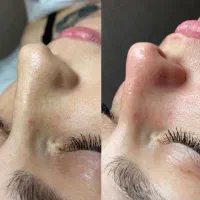 تخفیف ویژه پاکسازی پوست|خدمات آرایشگری و زیبایی|فولادشهر, C4|دیوار