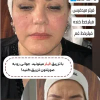 جشنواره تابستانی لیزر و زیبایی