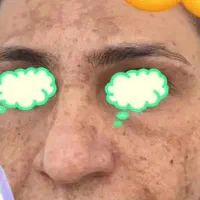 فرمول سفید کننده قوی  تضمینی میدم نتیجه طی سه روز|آرایشی، بهداشتی، درمانی|خاش, |دیوار