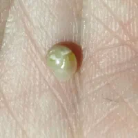 حلزون آلبینو|خزنده|پاکدشت, پاکدشت (مامازند)|دیوار