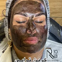 پاک کردن تتو با لیزر/ریموو ابرو/کربن تراپی(پزشک)|خدمات آرایشگری و زیبایی|مشهد, شهید فرامرز عباسی|دیوار