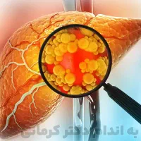 با کبد چرب خود برای همیشه  خداحافظی کنید