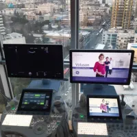 فروش تخصصی سونوگرافی GE آمریکا Voluson E8 E10