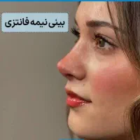 جشنواره جراحی بینی لیفت سینه صورت شکم اسلیو وبایپس|خدمات زیبایی و سلامت|تهران, میدان ولیعصر|دیوار