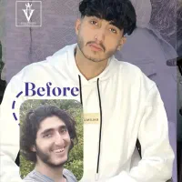 عمل بینی اقساطی(ماهانه۱۰)