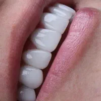 ارائه تمامی خدمات زیبایی با مناسب ترین قیمت|خدمات آرایشگری و زیبایی|تهران, دکتر هوشیار|دیوار