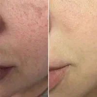 روشن کننده دائمی وتخصصی بدون بازگشت