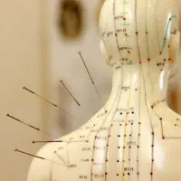 طب سوزنی و ماساژ درمانی