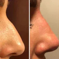 تزریق ژل و بوتاکس،فیلر بدن و لیفت با نخ|خدمات آرایشگری و زیبایی|کیش, |دیوار