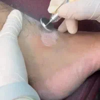 فیشیال روشن سازی نقاط تیره بدن صورت پدیکور پارافین