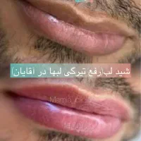 شید لب/رژلب/رفع لب تیره/مزووایت کرمپودر دایم|خدمات آرایشگری و زیبایی|اهواز, فرهنگ شهر|دیوار