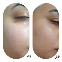 آموزش و خدمات پوست و فیشال|خدمات آرایشگری و زیبایی|مشهد, هفده شهریور|دیوار