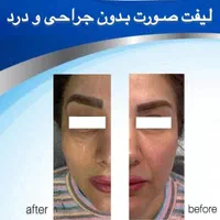 مرکز مراقبت پوست مو لاغری رشت|خدمات آرایشگری و زیبایی|رشت, گلباغ نماز|دیوار