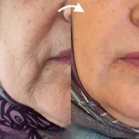 با بیوممتیک ایتالیایی و فرانسوی مشکلت حل میشه