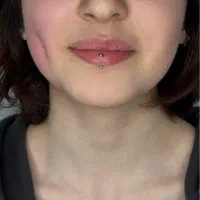 چالگونه/پیرسینگ