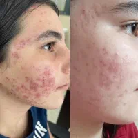 پاکسازی کبد چرب فقط در ۴۰ روز|آرایشی، بهداشتی، درمانی|گنبد کاووس, |دیوار