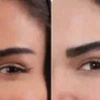 کاشت ابرو با نازلترین قیمت