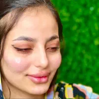 تخفیف ژل روفیل 650 بوتاکس600