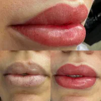 نیازمند مدل تتوی صورت