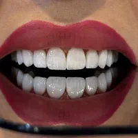 دستیار دندان پزشک