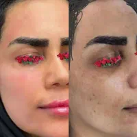 سفیدشو و جوان شو درب منزل پرداخت کن