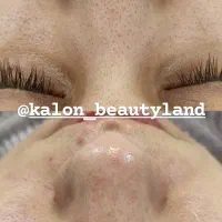 فیشال تخصصی پوست آقایان و بانوان|خدمات آرایشگری و زیبایی|گلبهار, شهر جدید گلبهار|دیوار