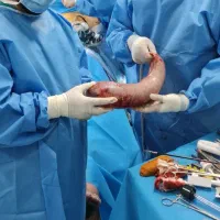 جراحی های چاقی و پیکر تراشی