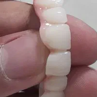 دندانسازی تاکستان|پزشکی|تاکستان, |دیوار