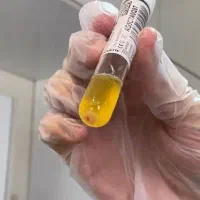 اموزش فشیال و پیرسینگ و prpوخالبرداری